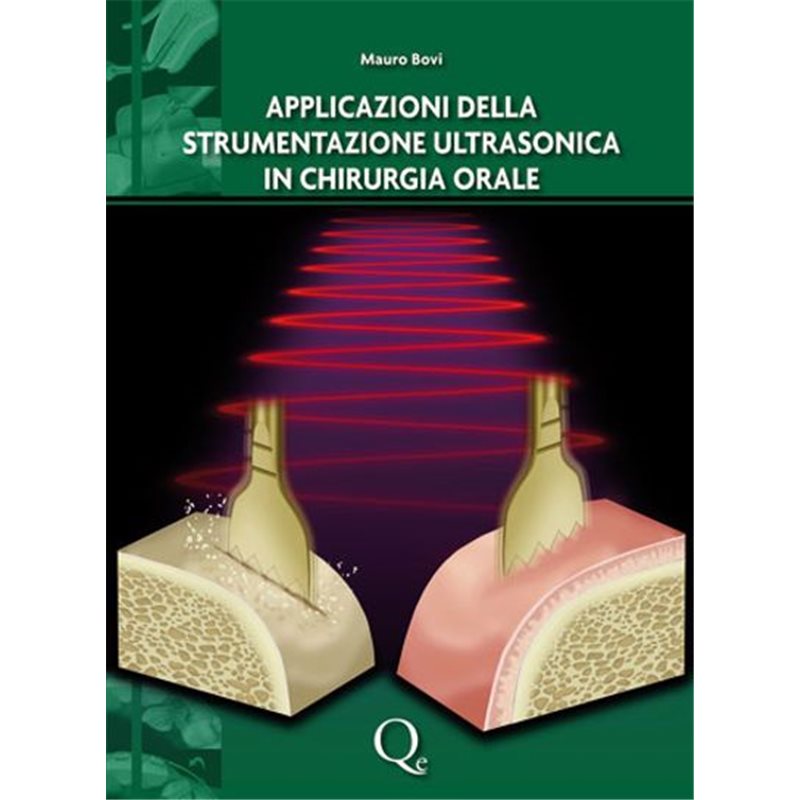 Applicazioni della strumentazione ultrasonica in chirurgia orale